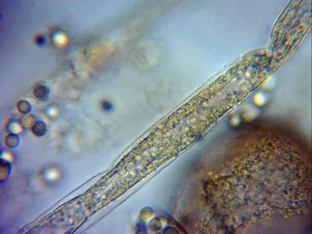 Microscopía de Mucor racemosus - 10 - Hifa melzer x 1000 y esporas